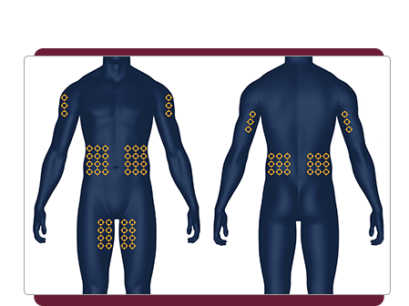 Hizentra Injection Sites